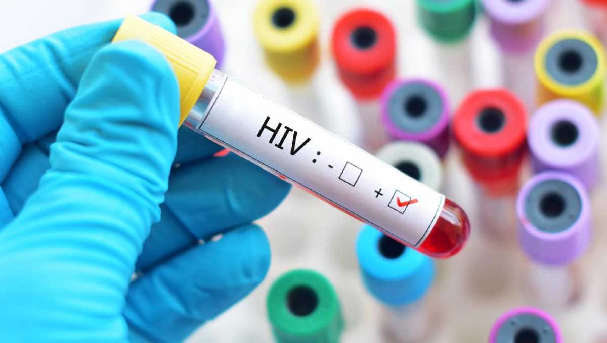 66 found HIV positive in Sylhet