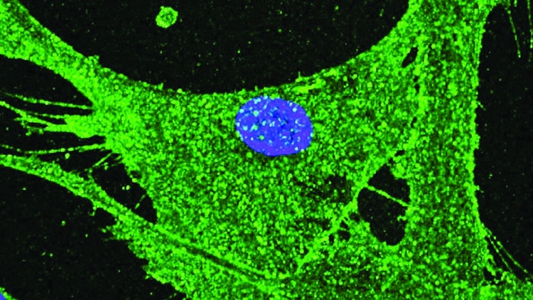 Scientists rejuvenate skin cells by 30 years