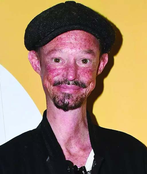 Game of Thrones actor Darren Kent passes away