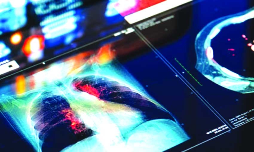 Trial results for new lung cancer drug are 'off the charts', say doctors