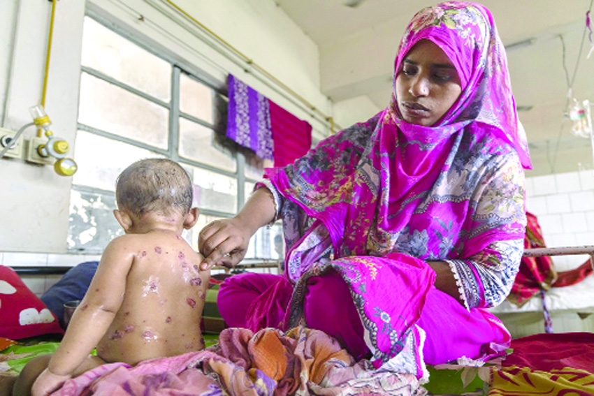 Measles outbreak: Yunus govt blamed for vaccine negligence