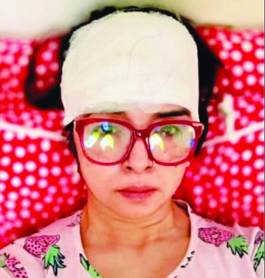 Actress Elina Shammi injured in  e-rickshaw accident