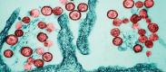 How worried should we be about hantavirus?