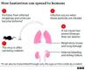 How worried  should we be about hantavirus?
