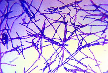 Livestock dept launches urgent, coordinated activities to roll back anthrax