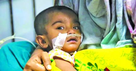 17 more deaths from measles, similar symptoms, highest in a single day