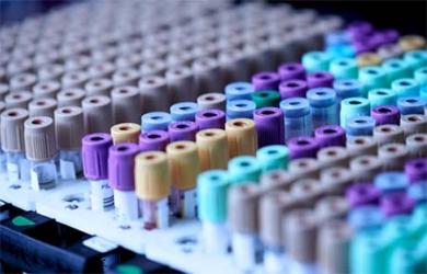 ACE-031 and the Expanding Landscape of Myostatin Pathway Modulation in Molecular Research 
