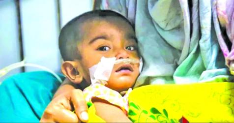 Measles: 8 more children die raising the total to 628