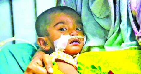 Measles: Deaths continue as toll hits 867