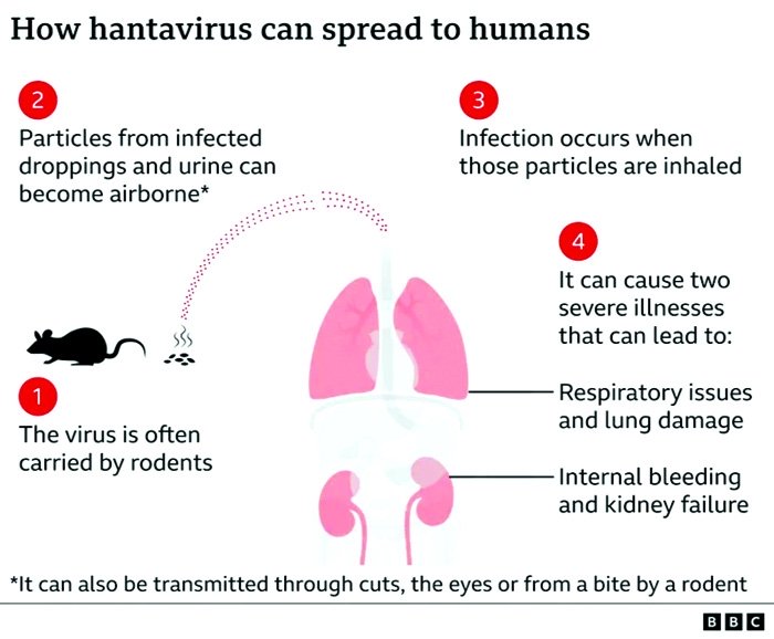 How worried  should we be about hantavirus?