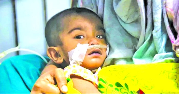 Measles: 8 more children die raising the total to 628
