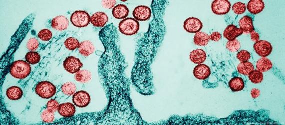 How worried should we be about hantavirus?